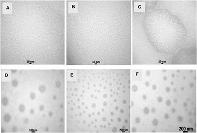 Nanoemulsion and nanoencapsulation of a hydroethanolic extract of Nettle (Urtica dioica) and Wormwood (Artemisia absinthium): comparison of antibacterial and anticancer activity